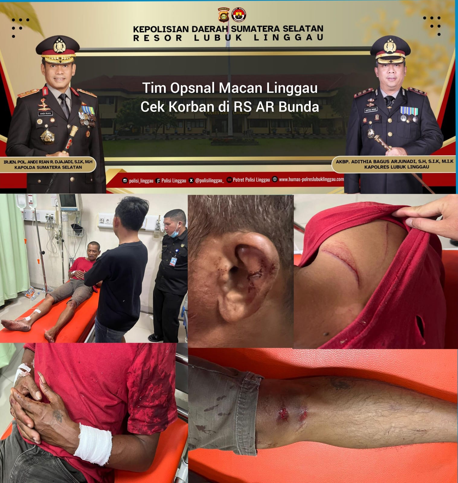 Dengan Alasan Ditabrak , Pelaku Pa (38)Membacok Korban RS (44)